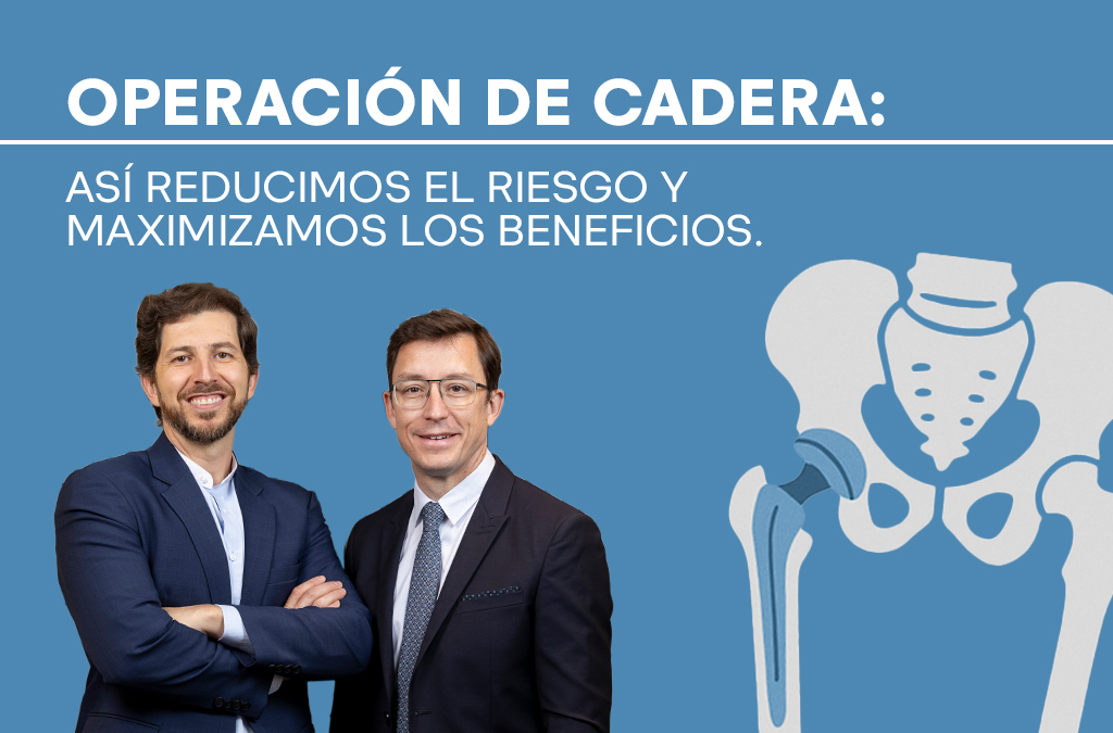 Operación de cadera: así reducimos el riesgo y maximizamos los beneficios