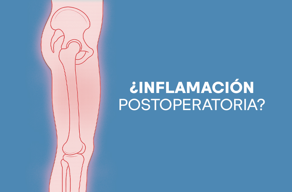 ¿Por qué se inflama la pierna después de una cirugía de cadera?